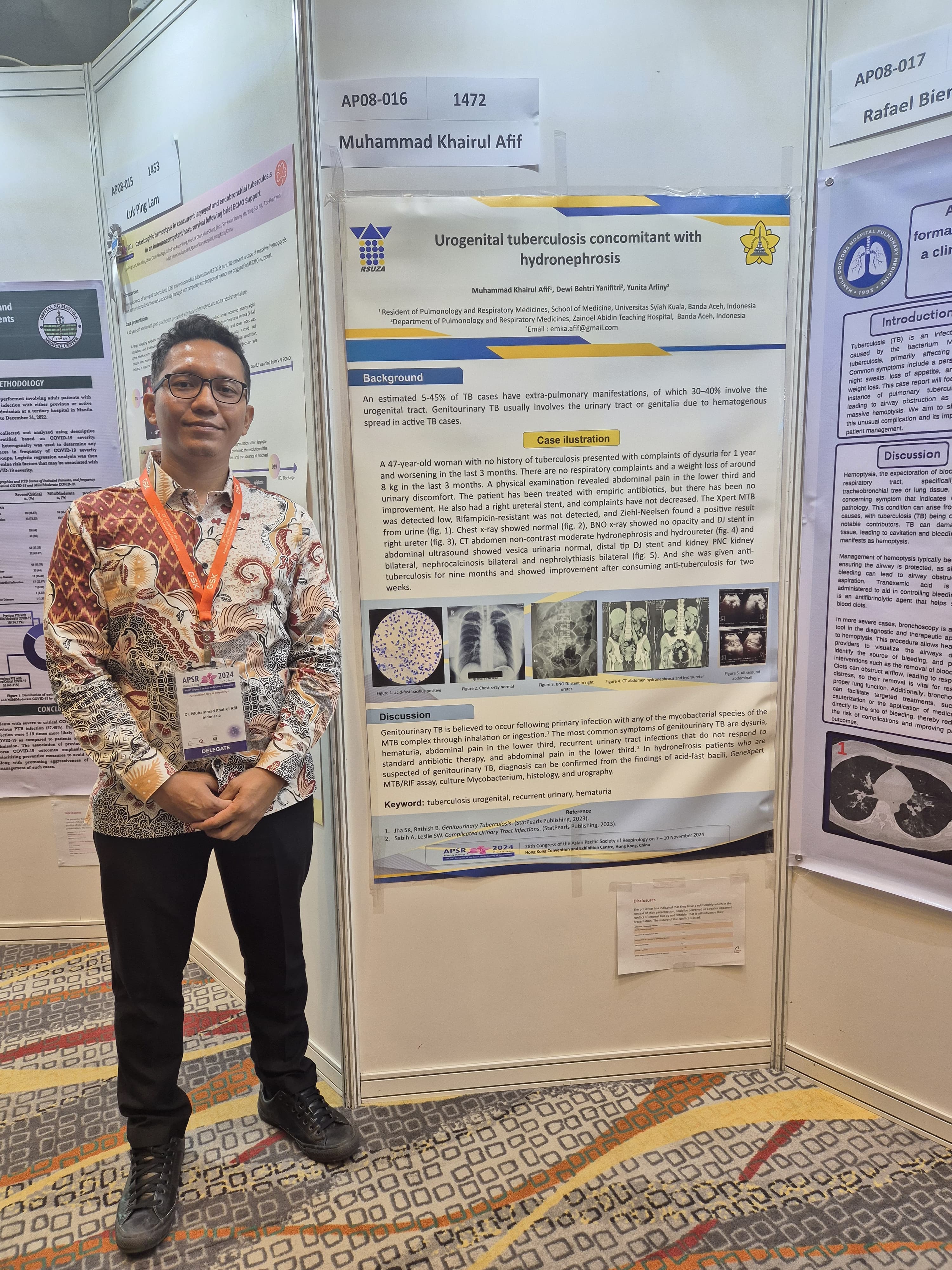 PPDS Pulmonologi Ikut menyemarakkan Kongres Internasional Asian Pacific Society of Respirology (APSR)