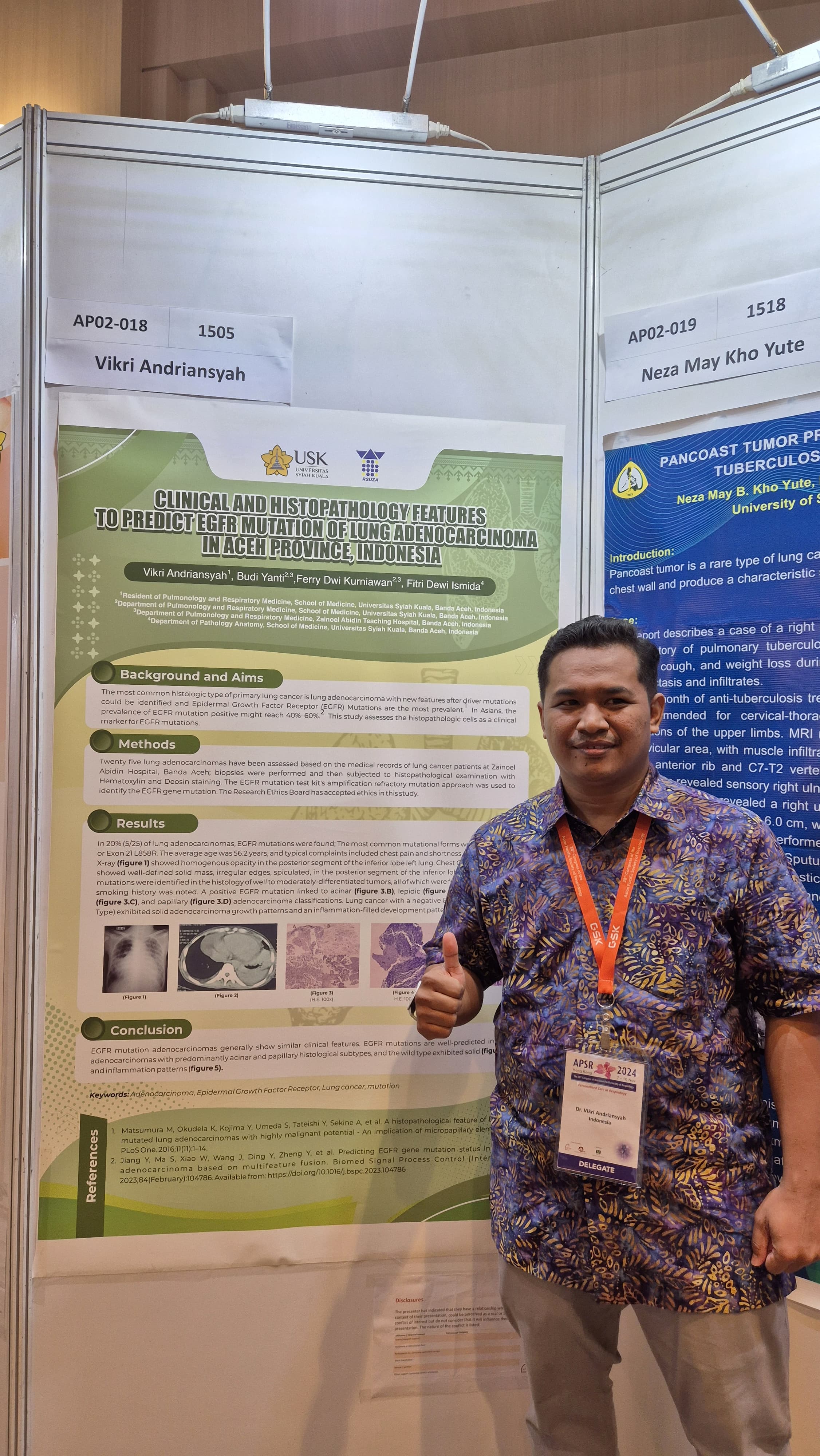 PPDS Pulmonologi Ikut menyemarakkan Kongres Internasional Asian Pacific Society of Respirology (APSR)