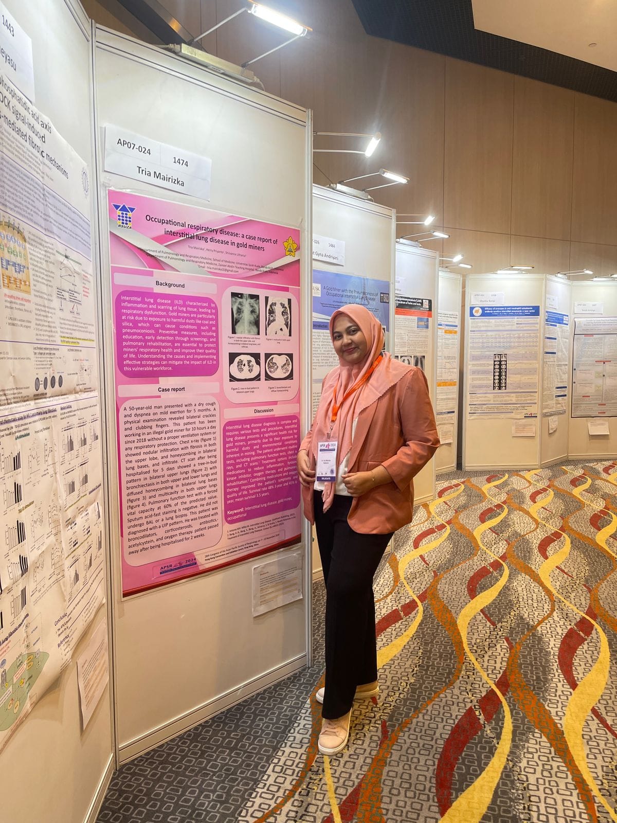 PPDS Pulmonologi Ikut menyemarakkan Kongres Internasional Asian Pacific Society of Respirology (APSR)